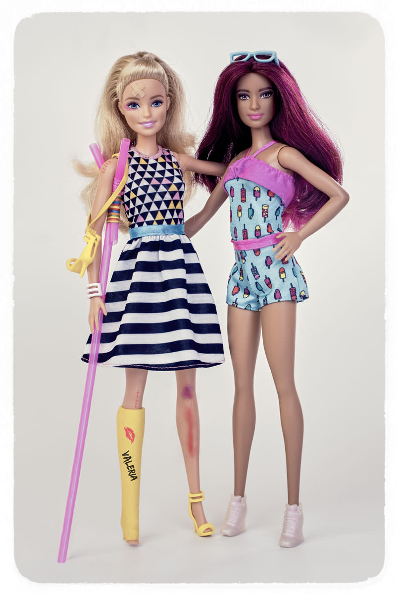 Broke Barbie Doll, wounded Barbie broken leg, barbies friends, friendship